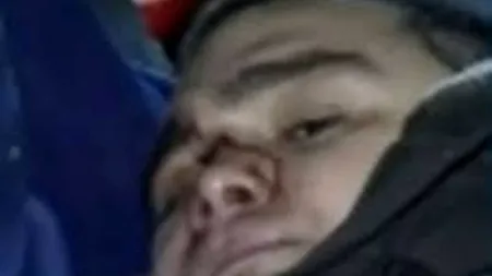 Cluj: Copilotul Răzvan Petrescu, rănit în accidentul din Apuseni, va fi operat a treia oară
