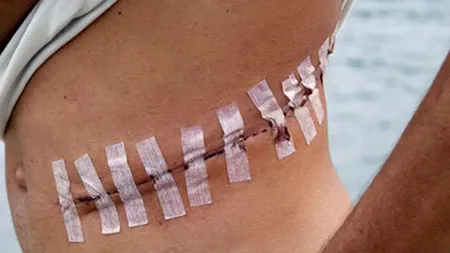 Cinci indivizi care încercau să cumpere un rinichi de la un imigrant sărac au fost arestați. Cine avea nevoie de transplant