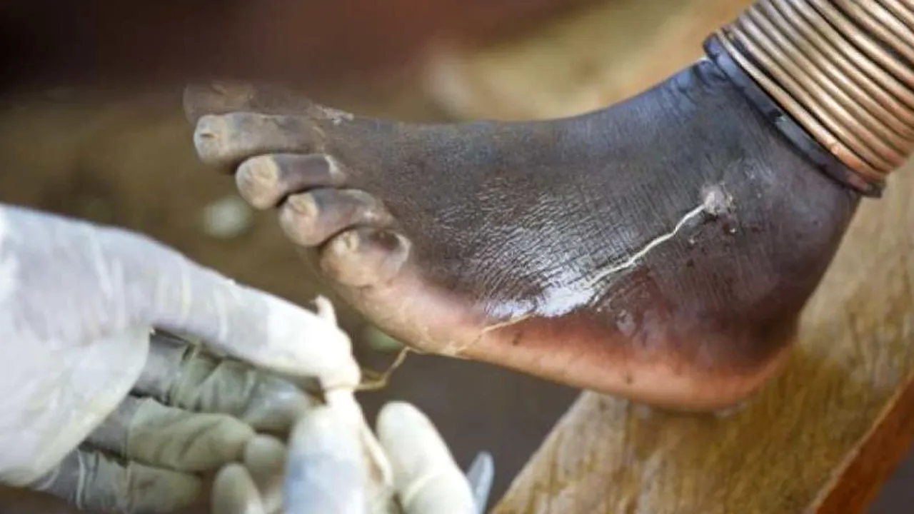 Prima boală care poate fi eradicată fără vaccinuri sau medicamente