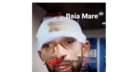 Un bărbat din Baia Mare susține că a fost bătut de polițiști, chiar în fața fiului de 6 ani, pentru că petrecea cu muzica prea tare: „Ne rugam de ei să nu îl mai lovească. Copilul lui plânge non stop”