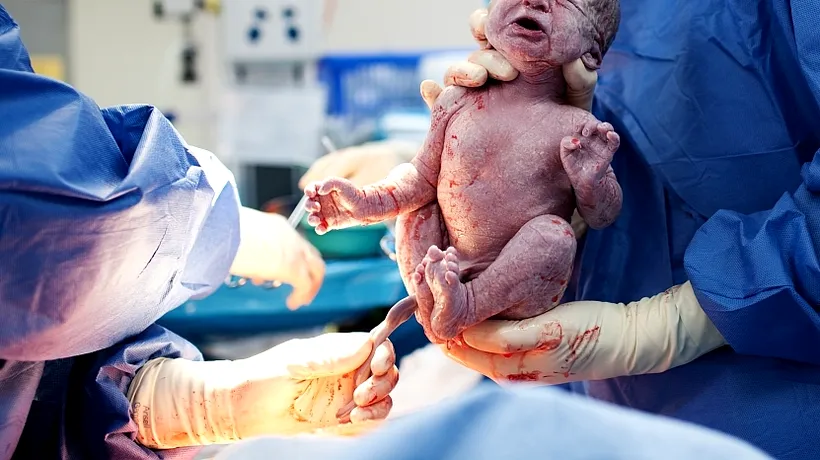 Riscul la care sunt expuși copiii născuți prin cezariană și ce complicații pot apărea în cazul femeilor care nasc prin această metodă