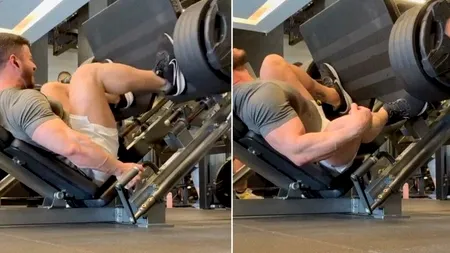 Un culturist a ajuns ajuns pe masa de operație după un exercițiu de forță cu 400 de kilograme