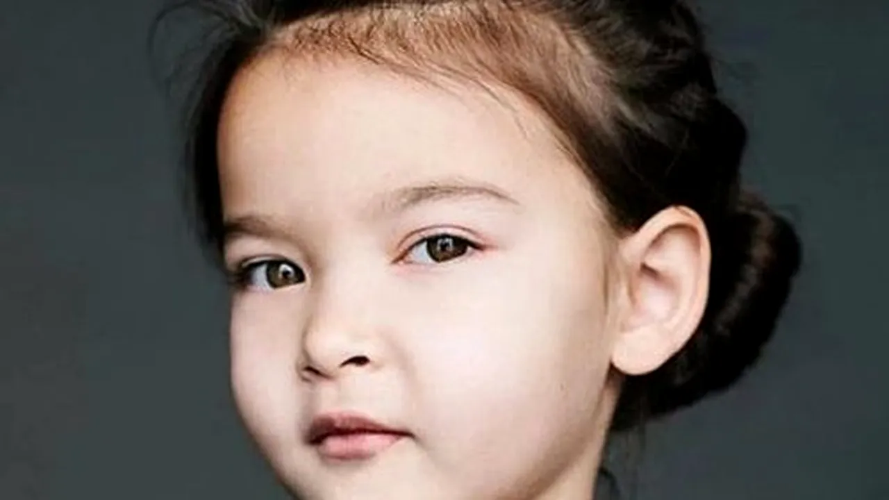 Când diversitatea înseamnă unicitate. 10 copii cu trăsături unice în lume. FOTO