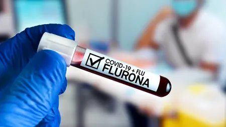 Ungaria a detectat primele cazuri de infectare simultană cu gripă și COVID