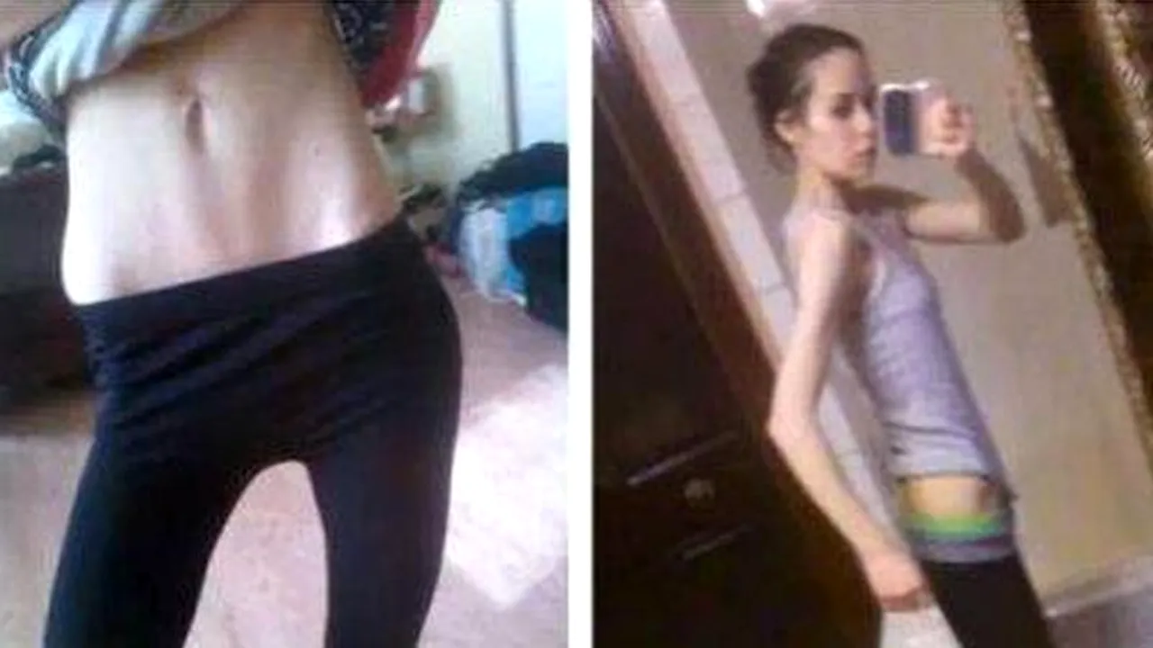 Transformare incredibilă în numai un an de zile a acestei tinere care cântărea doar 35 de kilograme