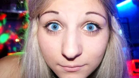 Desfigurată de operația estetică