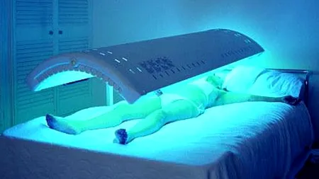 STUDIU. Ședințele la solar cresc riscul de cancer de piele cu 20%