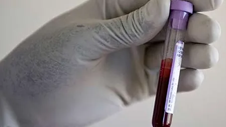 Sânge artificial creat de cercetători clujeni, testat pe șoareci cu rezultate încurajatoare