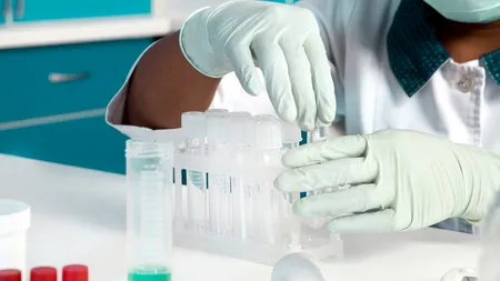 Cauzele rezultatelor false la testarea pentru COVID-19: „RT-PCR este un test foarte sensibil”