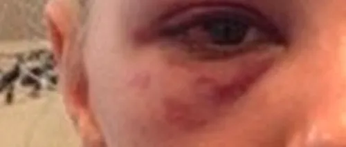 Alexandra Stan bătută. Tatăl artistei: Fata mea a fost aruncată ca o cârpă în stradă, bătută și plină de sânge. Am declanșat procesul legal. VIDEO
