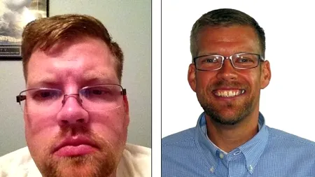 Schimbarea uimitoare prin care a trecut un bărbat de 150 de kilograme în doar un an - FOTO