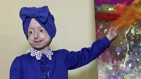 La 10 ani, arăta ca de 80. Cine a fost Benjamin Button în viața reală și boala rară de care suferea