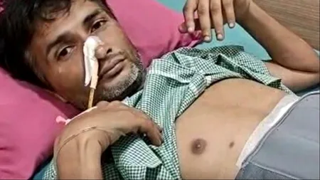 Ce au descoperit medicii în stomacul unui bărbat. Acesta s-a prezentat la urgențe cu dureri mari abdominale