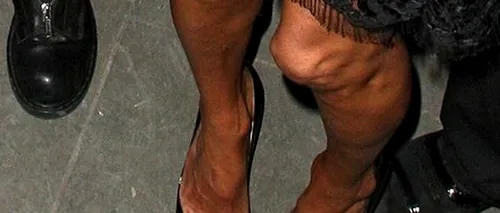 FOTO: Așa arată genunchii unuia dintre cele mai cunoscute manechine din lume