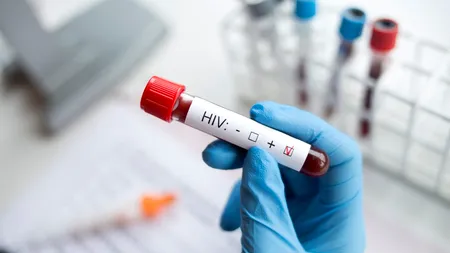 Mai mulți cercetători americani spun că este posibil să fi vindecat o pacientă de HIV