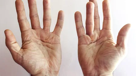 Cea mai MORTALĂ boală din lume. Are o rată de fatalitate de aproape 100%