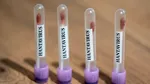 Pacientă infectată cu hantavirus, în stare gravă. Primește oxigen printr-un plămân artificial