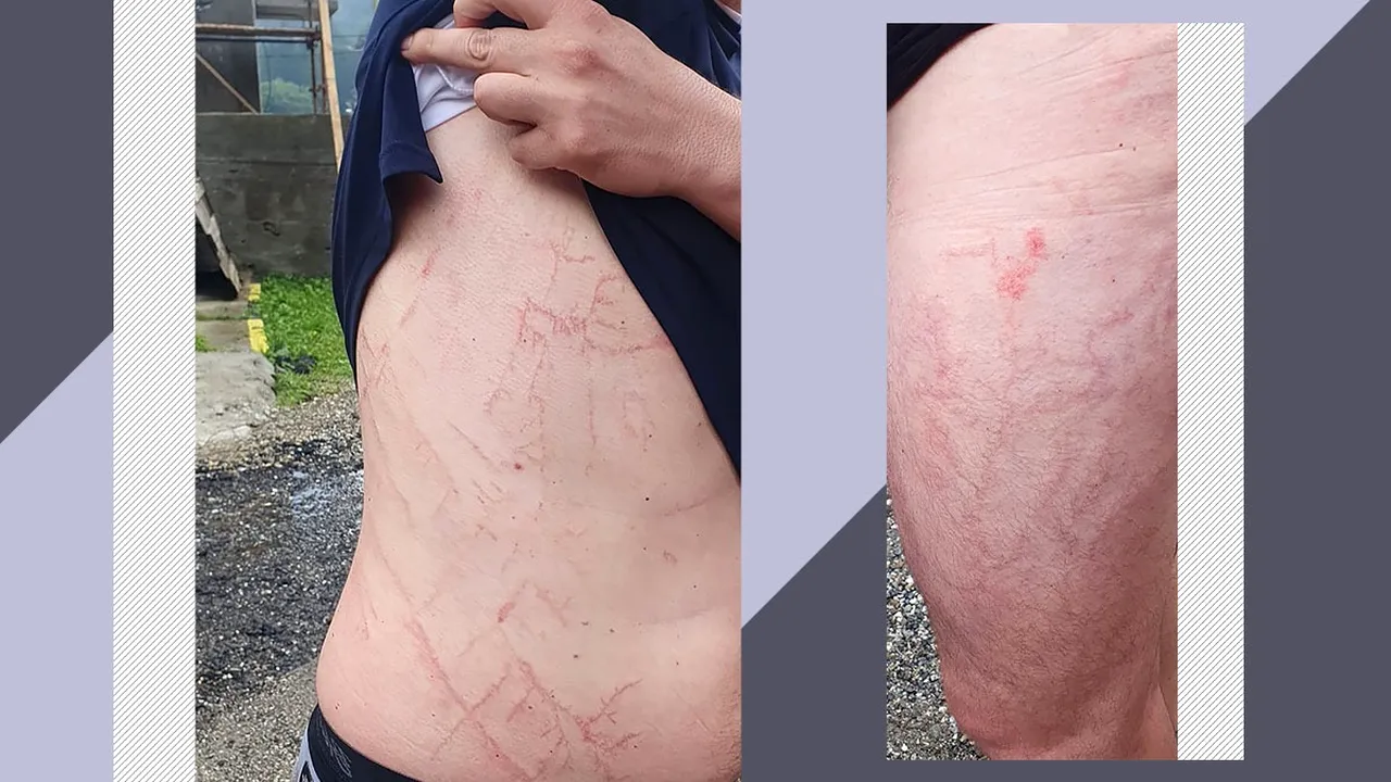 Un turist a fost lovit de FULGER, în Munții Făgăraș, și a supraviețuit. După ce a fost inconștient 30 de minute, bărbatul a coborât singur de pe munte