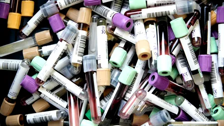 Diferențele de testare între anumite județe persistă. Capacitatea de testare în județul Maramureș nu a crescut. Unul din doi testați are COVID