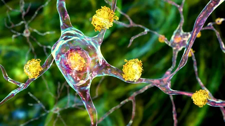 PREMIERĂ medicală: Specialiștii au reușit să trateze cu succes una dintre cele mai grave boli genetice, care afectează sute de mii de oameni