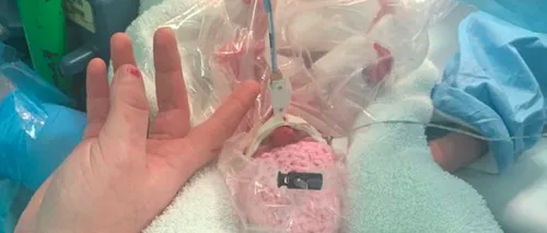 Un bebeluș născut prematur a supraviețuit ca prin minune! Medicii au folosit o metodă neobișnuită: punga de sandvici