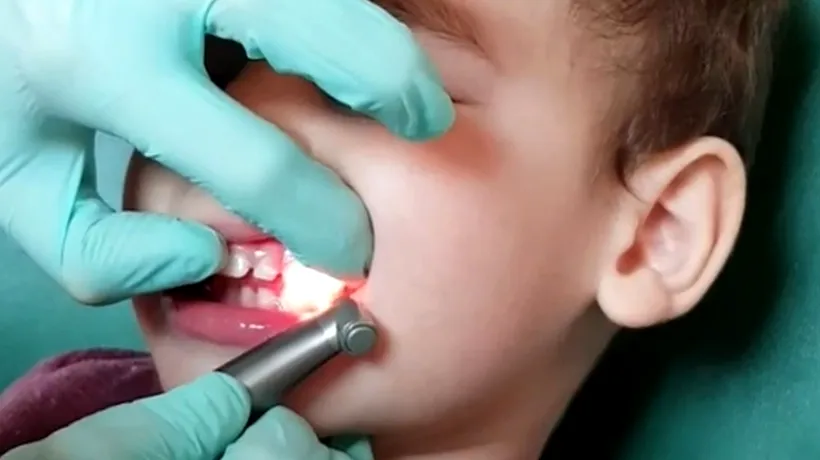 Cum îți înveți copilul să meargă la dentist. Sfaturile unui psiholog pentru părinți, la Gândul LIVE