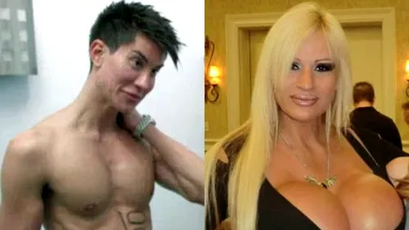 OPERAȚII ESTETICE DUSE LA EXTREM. Până unde sunt dispuși oamenii să meargă pentru a arăta bine