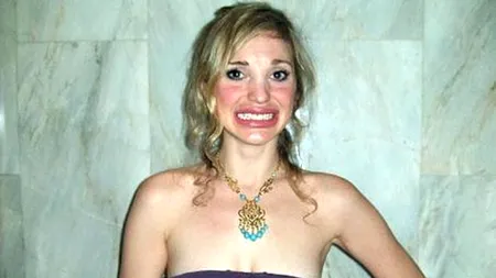 Mutilată de chirurgia plastică. Chinurile prin care a trecut o femeie aflată în căutarea 