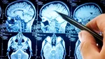 Creierul se formează din două „surse” diferite de celule. Ce spun cercetătorii de la Stanford
