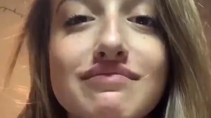 Un nou „trend periculos a apărut pe rețelele de socializare: Tinerele apelează la o metodă periculoasă pentru mărirea buzelor... lipiciul - VIDEO