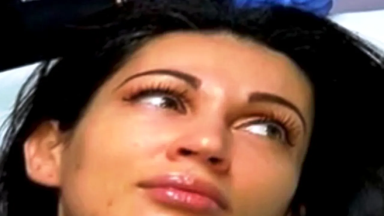 Care este explicația pentru probleme de ten ale Nicoletei Luciu