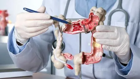 Campania de prevenție a cancerului colorectal continuă în județul Ilfov (P)