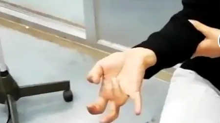 O femeie a rămas PARALIZATĂ după ce s-a jucat O SĂPTĂMÂNĂ întreagă pe telefon