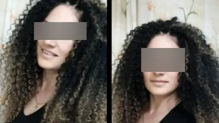 FOTO. Cum arătau plămânii femeii din Alba care a murit de Covid-19 la doar 39 de ani, deși nu avea alte boli