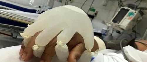 „Mâna lui Dumnezeu”. Asistenții medicali din Brazilia au venit cu o idee inovatoare pentru pacienții izolați la ATI. Fotografia a devenit virală