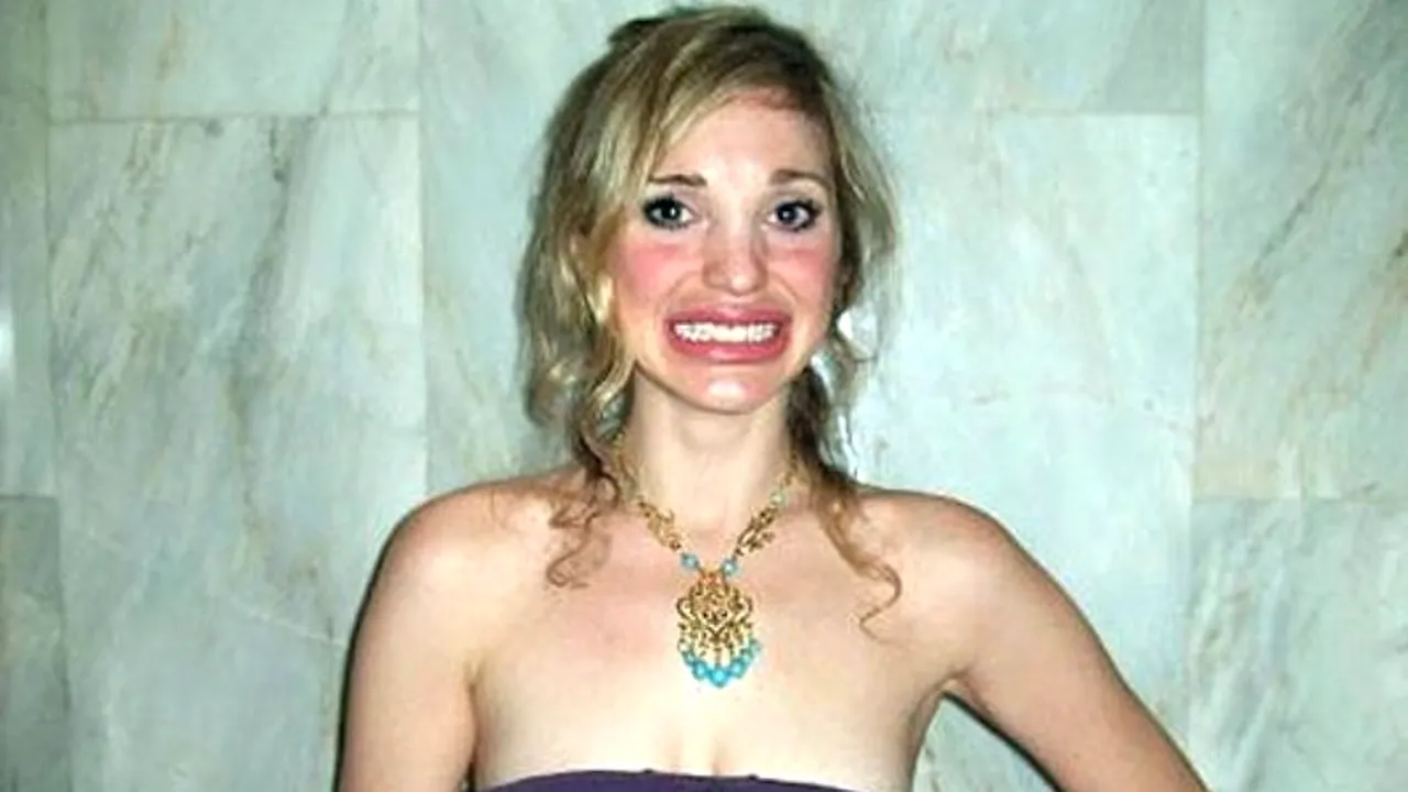 Mutilată de chirurgia plastică. Chinurile prin care a trecut o femeie aflată în căutarea 