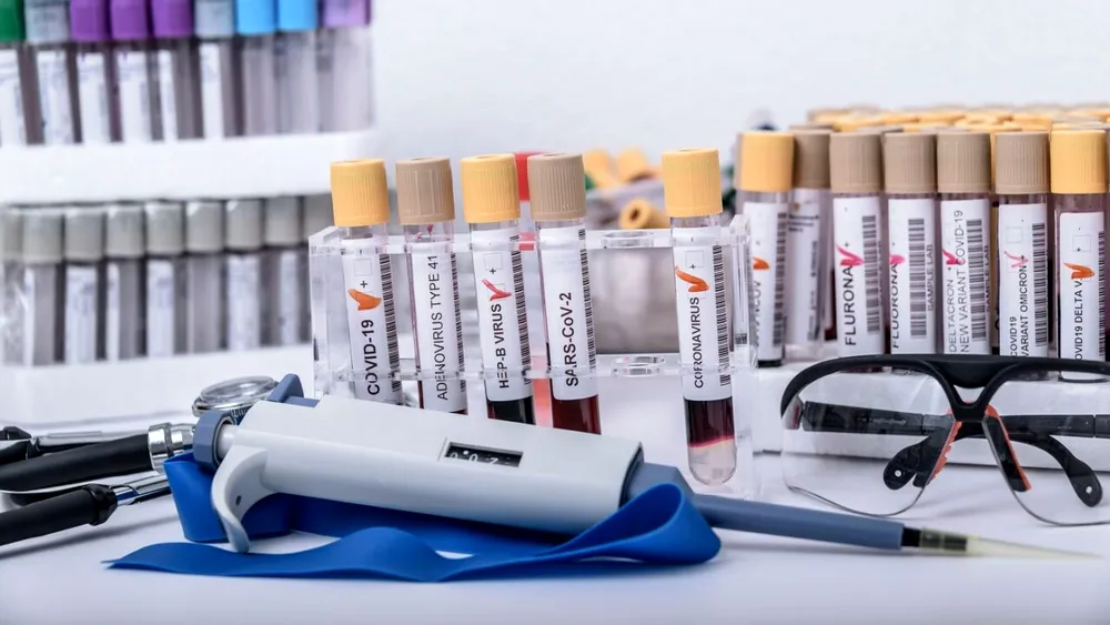 OMS: Ancheta privind originea Covid-19, fără CONCLUZII, din cauza lipsei de COOPERARE a Chinei și a mai multor agenții de informații