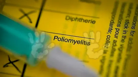 Un tânăr din New York a fost diagnosticat cu poliomielită. Este primul caz din ultimul deceniu detectat în SUA. Recomandările autorităților sanitare