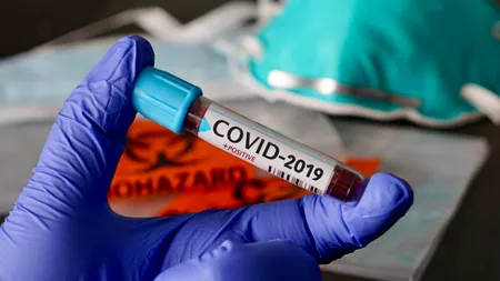 ANALIZĂ. Numărul de cazuri raportate de coronavirus s-a triplat în luna iunie faţă de mai