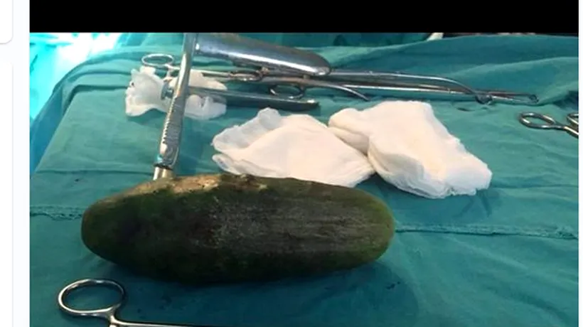 FOTO ȘOCANT! Ce a scos dintr-o pacientă un ginecolog de la noi, de Ziua Îndrăgostiților! Apoi a postat imaginea  asta pe Facebook!