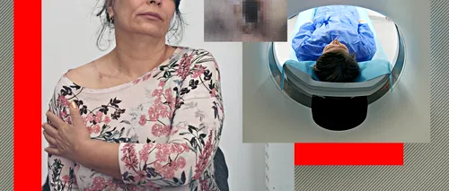 Acuzații GRAVE la adresa unei clinici din Craiova: O pacientă spune că a suferit o arsură de gradul III în timp ce făcea un RMN