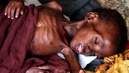 ONU avertizează: Riscul de foamete este în continuă creștere la nivel mondial. Peste 821 de milioane de persoane afectate