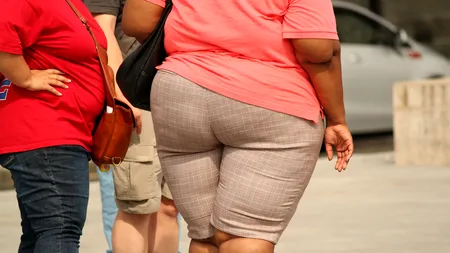 TOP 10: Meseriile cu cei mai mulți angajați care suferă de obezitate