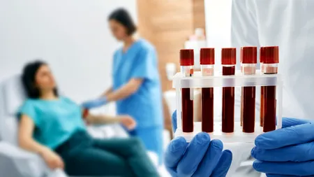 „Sângele de aur”, grupa sangvină pe care doar 50 de oameni din lume o au. De ce e atât de specială