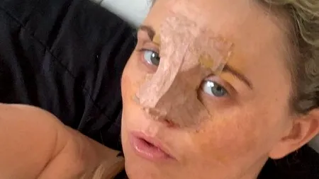 O mamă a găsit o metodă ciudată prin care și-a făcut o operație estetică gratuit, pe banii statului - FOTO 