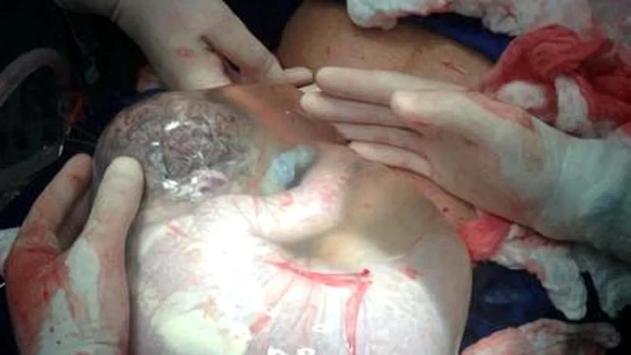  „Este incredibil, un astfel de caz este ULTRA RAR