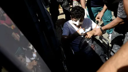 Cât de gravă este starea polițistului accidentat de milionarul turc