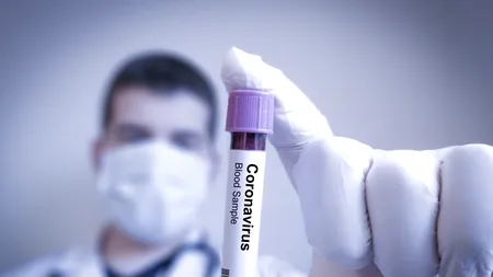 Condițiile în care asimptomaticii pot transmite SARS-COV-2