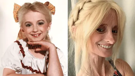 Povestea incredibilă a femeii care îmbătrânește de 8 ori mai repede decât ceilalți oameni: „Mi-am dat seama când au început să-mi cadă dinții că...” - FOTO