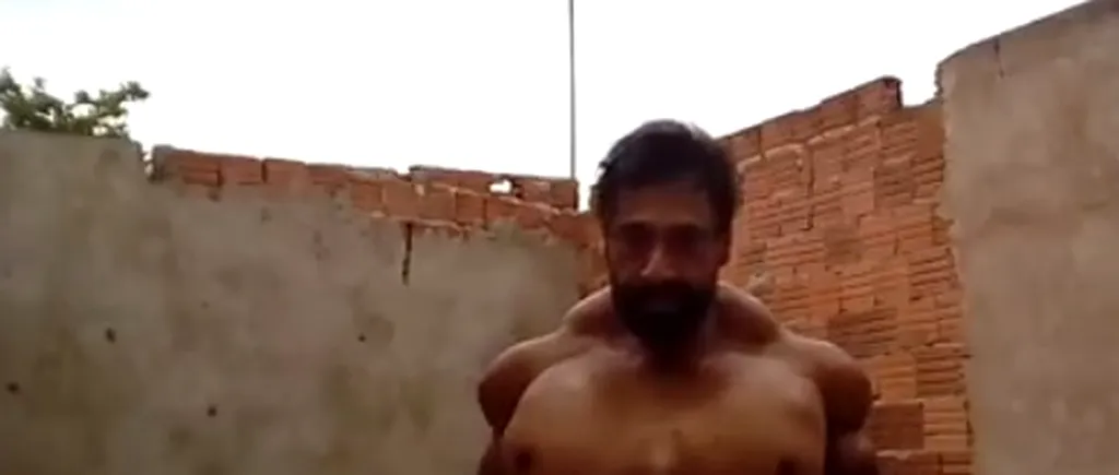 Bodybuilding dus la extrem: Un bărbat își injectează ulei în mușchi, ajungând să aibă proporții uriașe și riscând pierderea brațelor - FOTO / VIDEO 